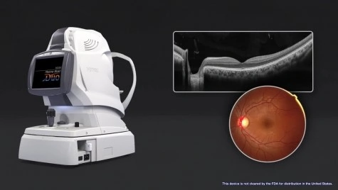 oct - tomografie oculara
