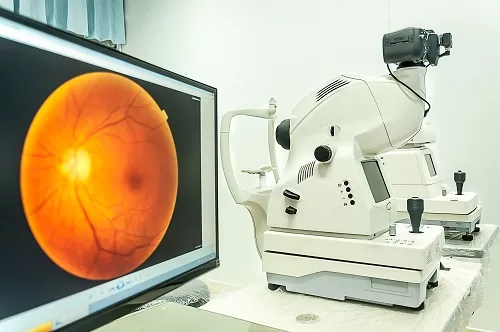 oftalmologie-iasi-fund-de-ochi-fotografie-fund-de-ochi